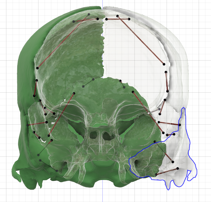 Elastic Placement in Fusion360
